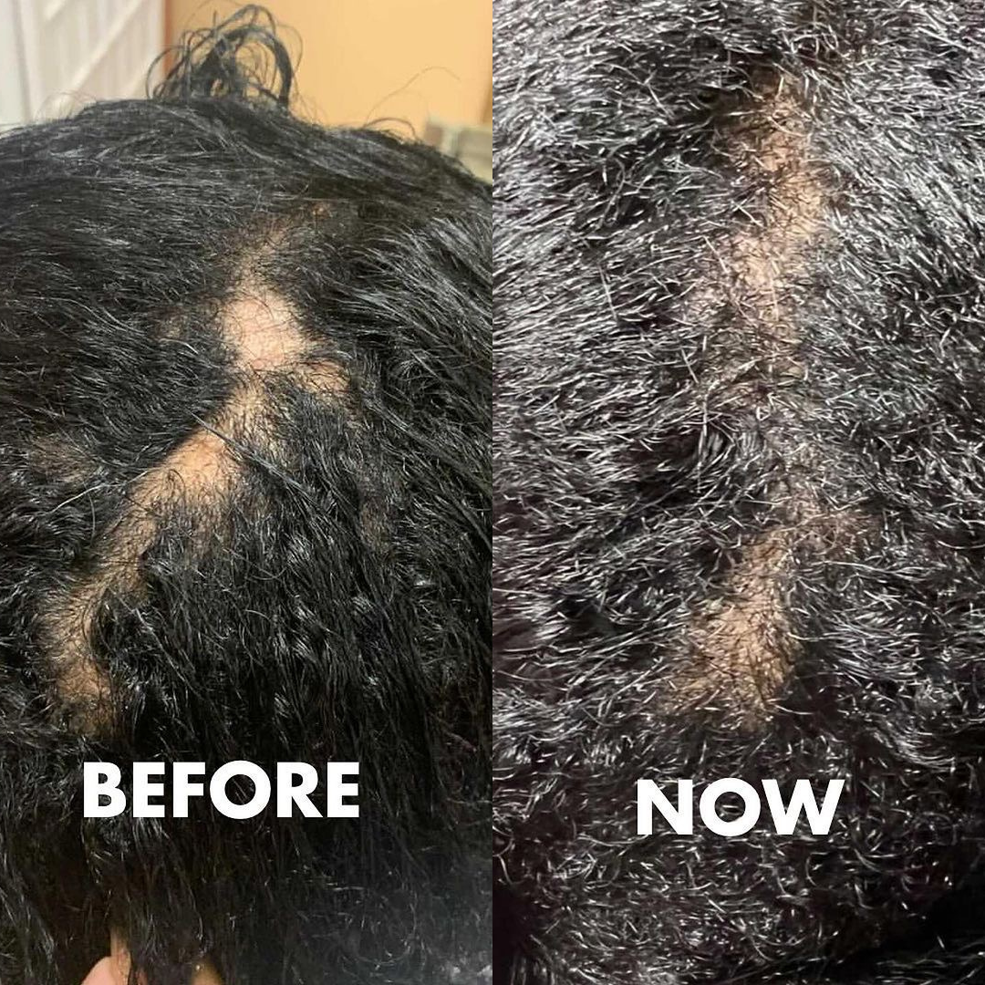 XL Afro Steam Cap 2.0 - Rescue Your Locs with Deep, Lasting Hydration